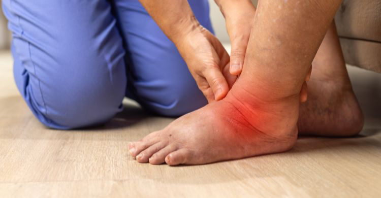 দীর্ঘ সময় বসে থাকলে পা ফুলে যাওয়া কিসের লক্ষণ 